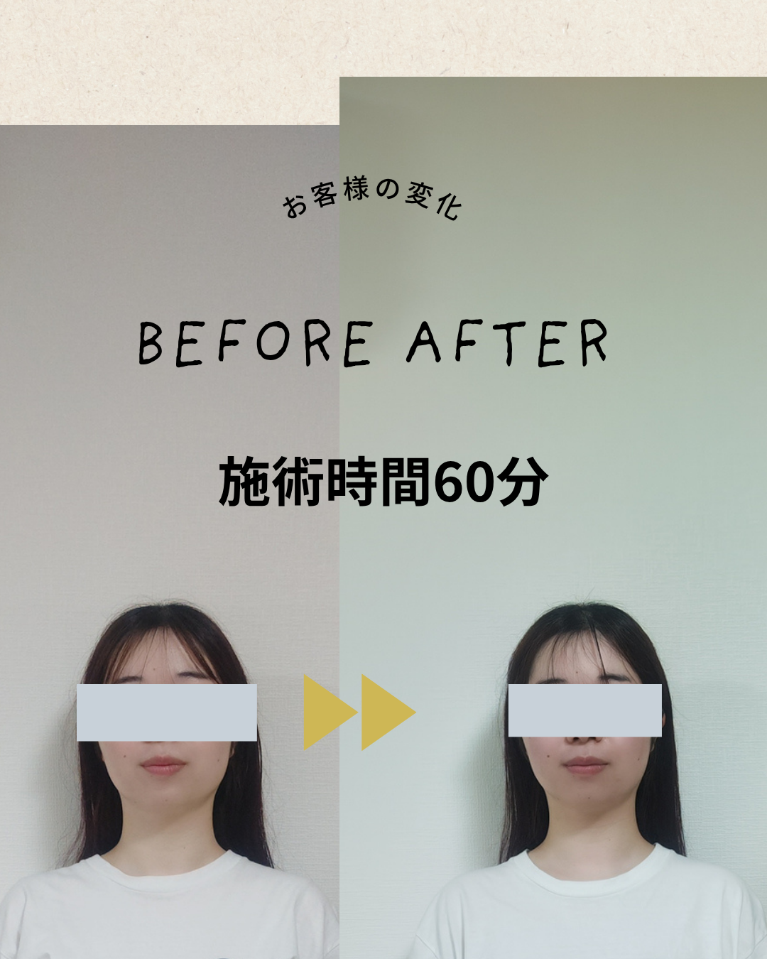 ビフォーアフター