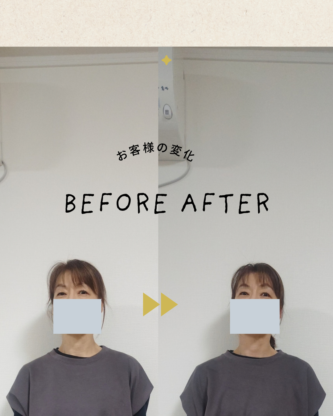 ビフォーアフター