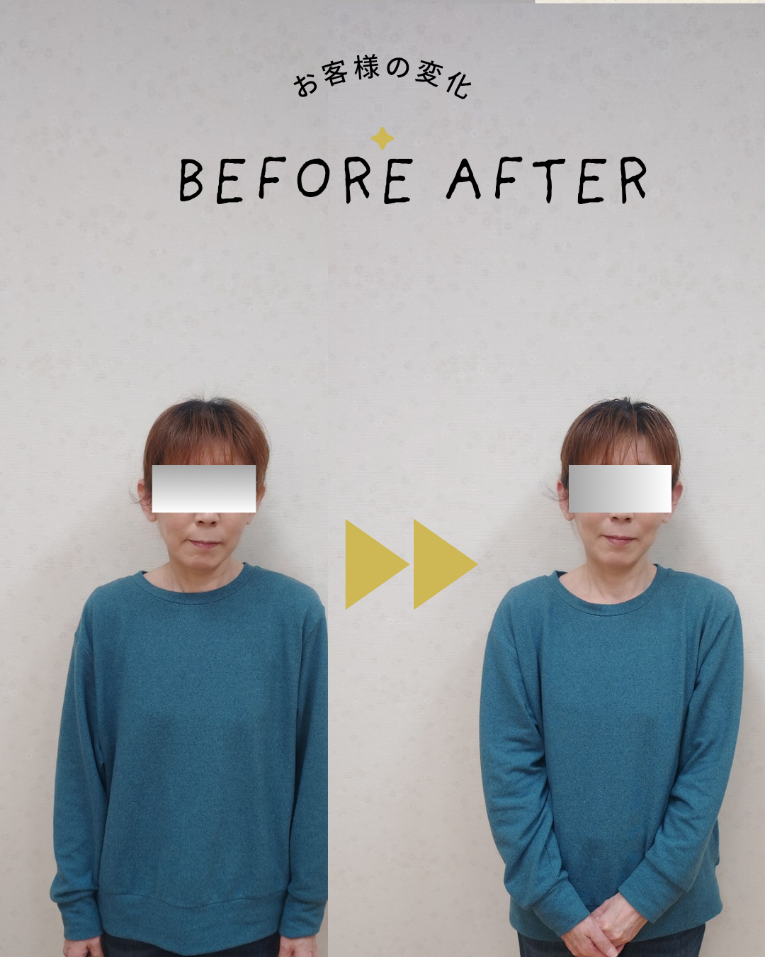 ビフォーアフター