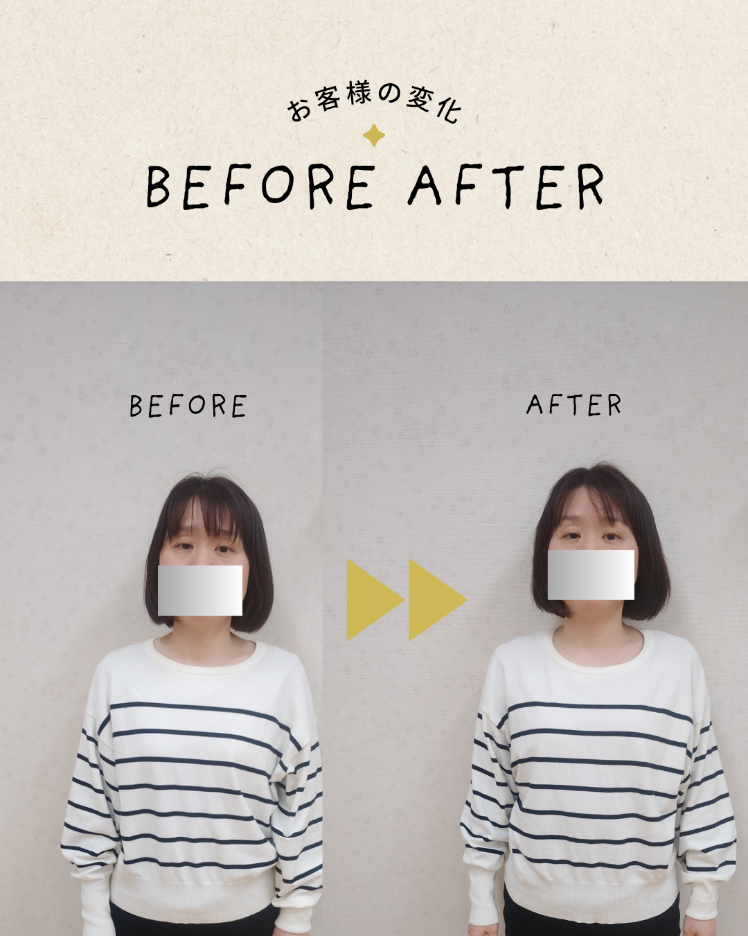 ビフォーアフター
